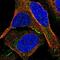 Junctional Cadherin 5 Associated antibody, PA5-53677, Invitrogen Antibodies, Immunofluorescence image 
