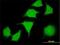 LIM Domain Kinase 2 antibody, H00003985-M01, Novus Biologicals, Immunocytochemistry image 