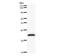 Zinc Finger Protein 544 antibody, LS-C342538, Lifespan Biosciences, Western Blot image 