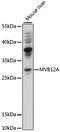 Multivesicular Body Subunit 12A antibody, 16-327, ProSci, Western Blot image 