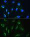 Neuroblastoma Amplified Sequence antibody, GTX66454, GeneTex, Immunocytochemistry image 