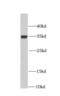 Charged Multivesicular Body Protein 4B antibody, FNab01660, FineTest, Western Blot image 