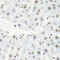 Heterogeneous nuclear ribonucleoprotein R antibody, 19-917, ProSci, Immunohistochemistry paraffin image 