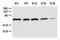 Zinc finger protein ZIC 1 antibody, NB600-488, Novus Biologicals, Western Blot image 