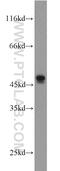 L-2-Hydroxyglutarate Dehydrogenase antibody, 15707-1-AP, Proteintech Group, Western Blot image 