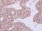 hRAD50 antibody, NBP2-20055, Novus Biologicals, Immunohistochemistry paraffin image 