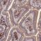 Meiosis Regulator For Oocyte Development antibody, PA5-60162, Invitrogen Antibodies, Immunohistochemistry frozen image 