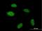 Pogo Transposable Element Derived With ZNF Domain antibody, H00023126-B01P, Novus Biologicals, Immunofluorescence image 