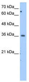 Malate dehydrogenase, cytoplasmic antibody, TA346603, Origene, Western Blot image 