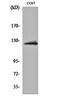 ATP Citrate Lyase antibody, orb160067, Biorbyt, Western Blot image 