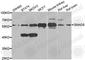 SMAD Family Member 5 antibody, A1947, ABclonal Technology, Western Blot image 