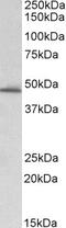 Synaptosome Associated Protein 25 antibody, 45-149, ProSci, Western Blot image 