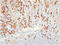 Plasma Cell Marker antibody, AM33283PU-T, Origene, Immunohistochemistry frozen image 