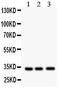 N-Methylpurine DNA Glycosylase antibody, PA5-79691, Invitrogen Antibodies, Western Blot image 