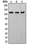 ERCC Excision Repair 4, Endonuclease Catalytic Subunit antibody, LS-C352164, Lifespan Biosciences, Western Blot image 