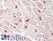Natriuretic Peptide B antibody, LS-B12936, Lifespan Biosciences, Immunohistochemistry paraffin image 