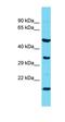 LOC684800 antibody, orb326090, Biorbyt, Western Blot image 