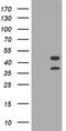Transmembrane Protein 173 antibody, TA505023S, Origene, Western Blot image 