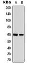 Zinc Finger C3HC-Type Containing 1 antibody, LS-C368551, Lifespan Biosciences, Western Blot image 