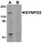 Synaptopodin 2 antibody, PA5-21055, Invitrogen Antibodies, Western Blot image 