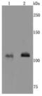 Glutamate Ionotropic Receptor NMDA Type Subunit 1 antibody, NBP2-66982, Novus Biologicals, Western Blot image 