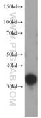 Thymidylate Synthetase antibody, 15047-1-AP, Proteintech Group, Western Blot image 