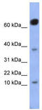 NK6 Homeobox 3 antibody, TA345551, Origene, Western Blot image 
