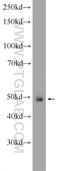 Ankyrin Repeat Domain 33 antibody, 25202-1-AP, Proteintech Group, Western Blot image 