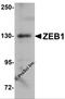 Zinc Finger E-Box Binding Homeobox 1 antibody, 5825, ProSci Inc, Western Blot image 