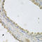 Mitochondrial Transcription Termination Factor 3 antibody, STJ111846, St John