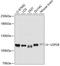 Ubiquitin carboxyl-terminal hydrolase 28 antibody, A05040-2, Boster Biological Technology, Western Blot image 