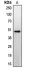 Cholecystokinin B Receptor antibody, MBS821752, MyBioSource, Western Blot image 