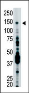 HAUSP antibody, AP12016PU-N, Origene, Western Blot image 
