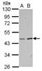 Bile acid-CoA:amino acid N-acyltransferase antibody, NBP2-15535, Novus Biologicals, Western Blot image 
