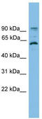 Ankyrin Repeat And EF-Hand Domain Containing 1 antibody, TA344702, Origene, Western Blot image 