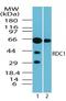 Atypical Chemokine Receptor 3 antibody, TA337066, Origene, Western Blot image 