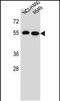 Leucine Rich Repeat Containing 6 antibody, PA5-48269, Invitrogen Antibodies, Western Blot image 