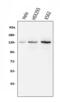 BUB1 Mitotic Checkpoint Serine/Threonine Kinase B antibody, M01564-2, Boster Biological Technology, Western Blot image 