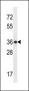 E2F Associated Phosphoprotein antibody, LS-C167603, Lifespan Biosciences, Western Blot image 