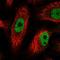 PHD finger protein 12 antibody, HPA021452, Atlas Antibodies, Immunocytochemistry image 