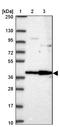 Ankyrin Repeat Domain 33 antibody, NBP2-32400, Novus Biologicals, Western Blot image 
