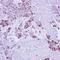 Cofilin 2 antibody, orb73743, Biorbyt, Immunohistochemistry paraffin image 
