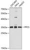 Phosphopantothenoylcysteine Synthetase antibody, 14-649, ProSci, Western Blot image 