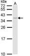 MHC II HLA-DR beta antibody, TA308896, Origene, Western Blot image 