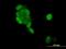 Progesterone Receptor antibody, H00005241-M08, Novus Biologicals, Immunofluorescence image 