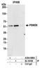 Proteasome 26S Subunit, Non-ATPase 5 antibody, A304-999A, Bethyl Labs, Immunoprecipitation image 