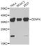Centromere Protein K antibody, A7627, ABclonal Technology, Western Blot image 