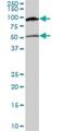 Methyl-CpG Binding Protein 2 antibody, H00004204-M01, Novus Biologicals, Western Blot image 