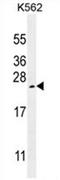 VPF antibody, AP54507PU-N, Origene, Western Blot image 