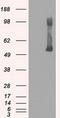 Glucokinase antibody, LS-C114560, Lifespan Biosciences, Western Blot image 